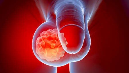 Digital illustration of the prostate gland used to visually support men’s health awareness.